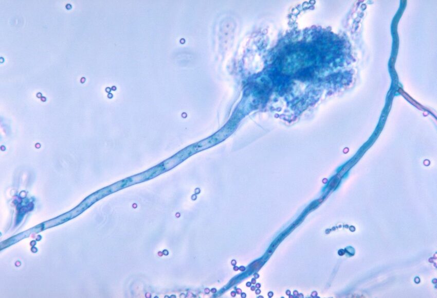 aspergillius niebieski By CDC/Dr. Libero Ajello (PHIL #4297), - Obtained from the CDC Public Health Image Library., Domena publiczna, https://commons.wikimedia.org/w/index.php?curid=924867
