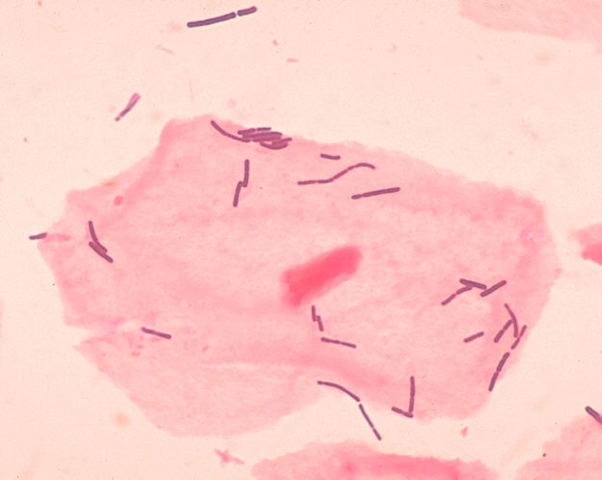 rózowe lacto bacillus   By Photo Credit: Janice CarrContent Providers(s):	CDC/Dr. Mike Miller - This media comes from the Centers for Disease Control and Prevention's Public Health Image Library (PHIL), with identification number #1048.Note: Not all PHIL images are public domain; be sure to check copyright status and credit authors and content providers.Deutsch | English | македонски | slovenščina | +/−, Domena publiczna, https://commons.wikimedia.org/w/index.php?curid=640855